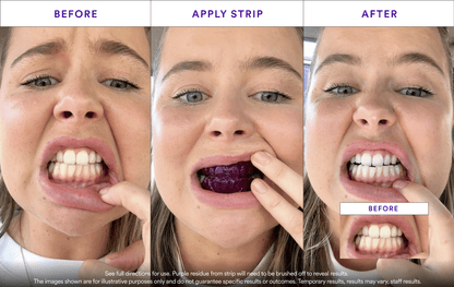Affordable Whitening Set